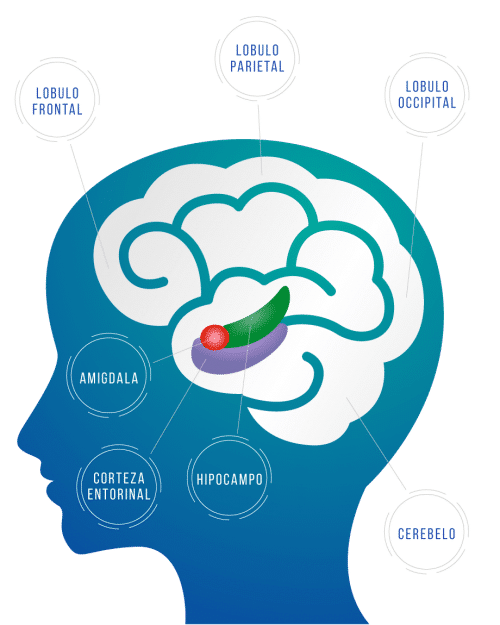 Esquema del cerebro mostrando amígdala hipocampo y corteza prefrontal en terapia EMDR